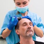 Hair Transplant – Facts and Myths